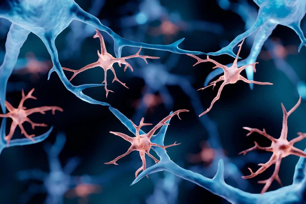 Breakthrough in Treating ALSP: Microglia Replacement Therapy Offers New Hope for Neurological Disorders