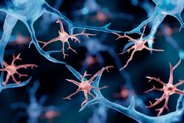 Breakthrough in Treating ALSP: Microglia Replacement Therapy Offers New Hope for Neurological Disorders