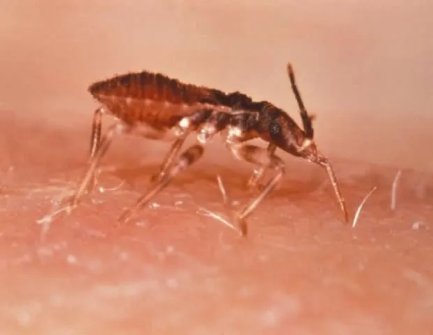 Chagas Parasite Transformation Linked to tRNA Chemical Alterations