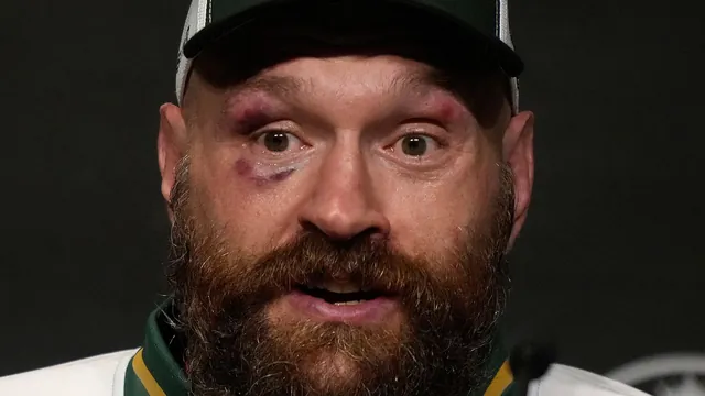 Tyson Fury Declares Himself the Sole Challenger to Oleksandr Usyk's Heavyweight Throne