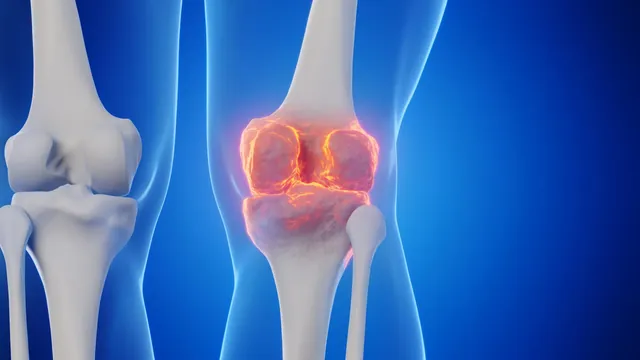 Stanford Scientists Discover Method to Regrow Cartilage, Potentially Ending Need for Joint Replacements