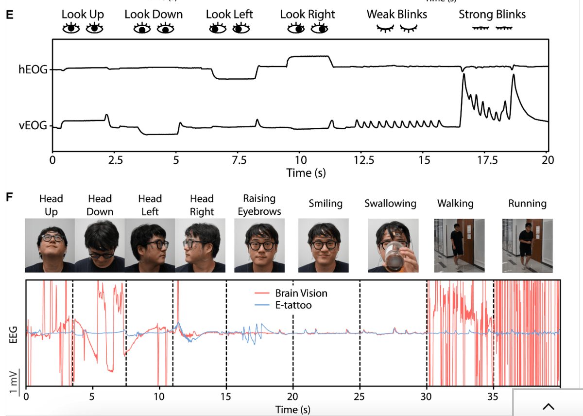 Electronic Face Tattoo Predicts Mental Strain with 90% Accuracy in Real-Time Monitoring