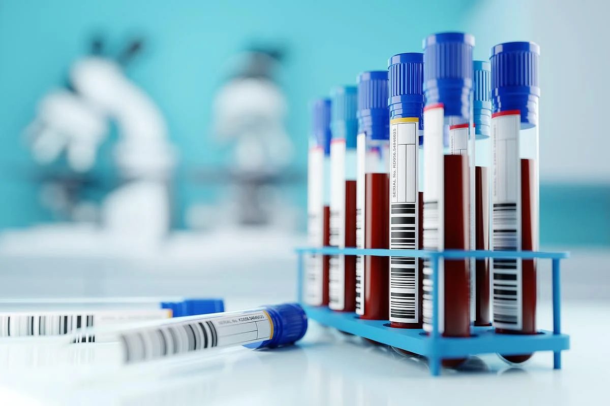 FDA Approves First Autonomous Blood-Drawing Robot, Aletta, Amid Phlebotomist Shortage