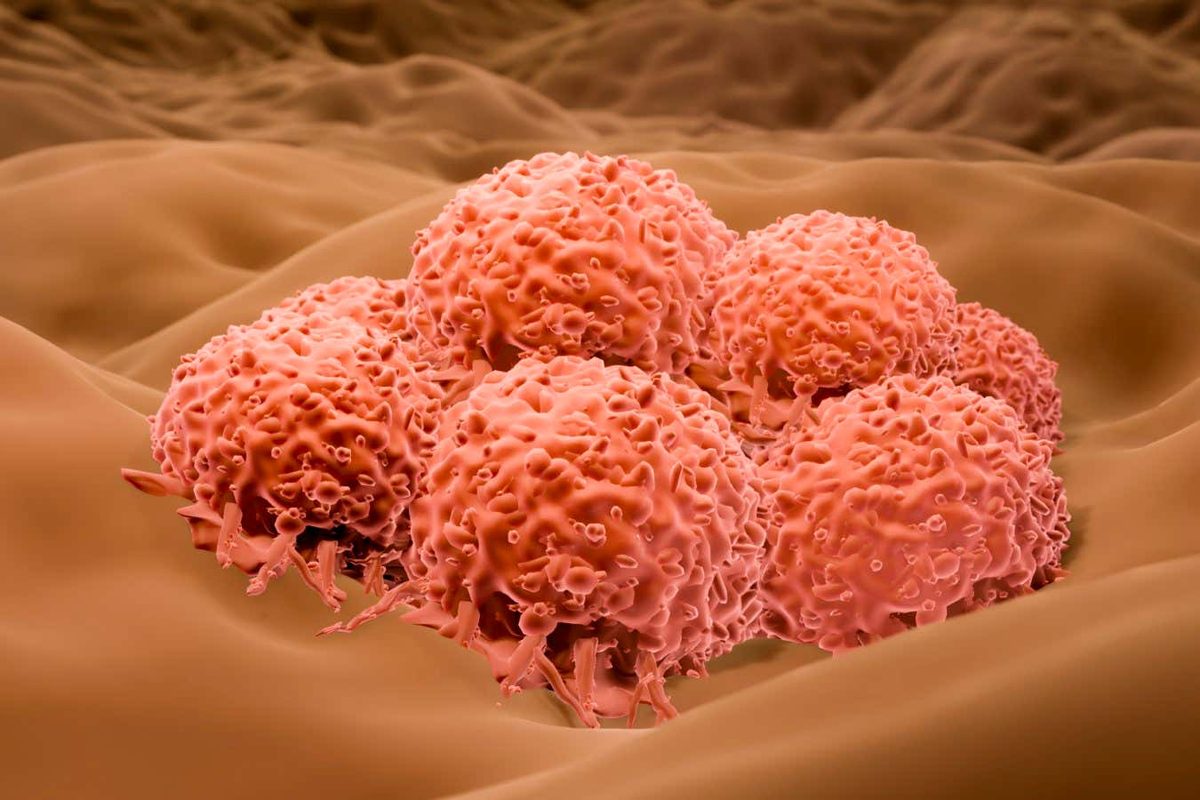 Innovative Herpes Virus Therapy Shows Promise Against Advanced Skin Cancer
