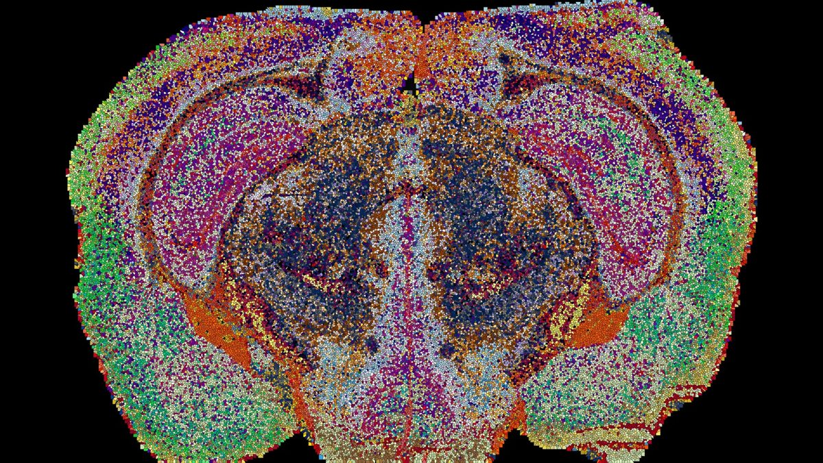 Scientists Unveil 539 Distinct Chemical Brain Zones, Revealing Hidden Lipid Map