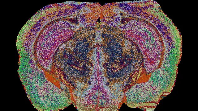 Scientists Unveil 539 Distinct Chemical Brain Zones, Revealing Hidden Lipid Map