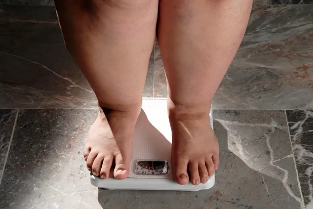 Economic Growth Fuels Global Obesity Surge: The Hidden Impact of Ultra-Processed Foods