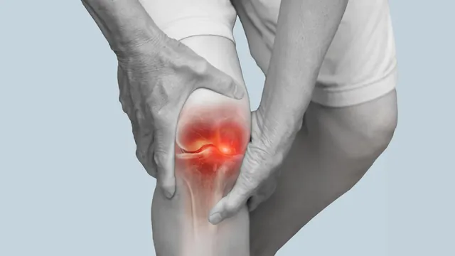 Walking Angle Adjustment Eases Knee Arthritis Pain, Slows Cartilage Damage