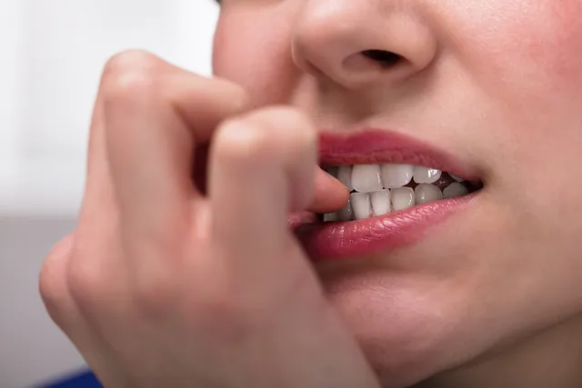 Nail Biting: A Germ-Infested Habit with Significant Health Risks
