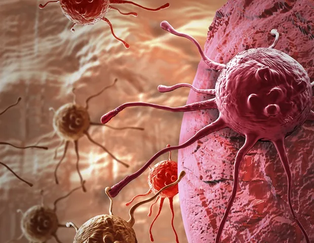 China's Lung Cancer Deaths Rise Despite Falling Rates, Driven by Aging Population
