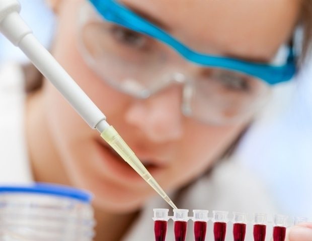 New Blood Protein Biomarkers Show Lingering Gut Inflammation in Coeliac Disease Patients